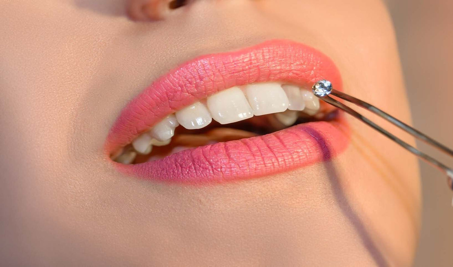 Comment Poser Facilement des Bijoux Dentaires ?