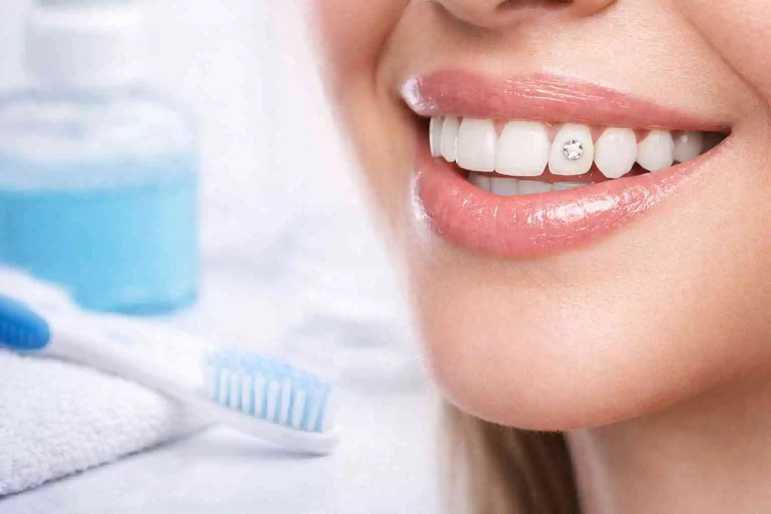 Durée de vie d’un strass dentaire : tenue et entretien