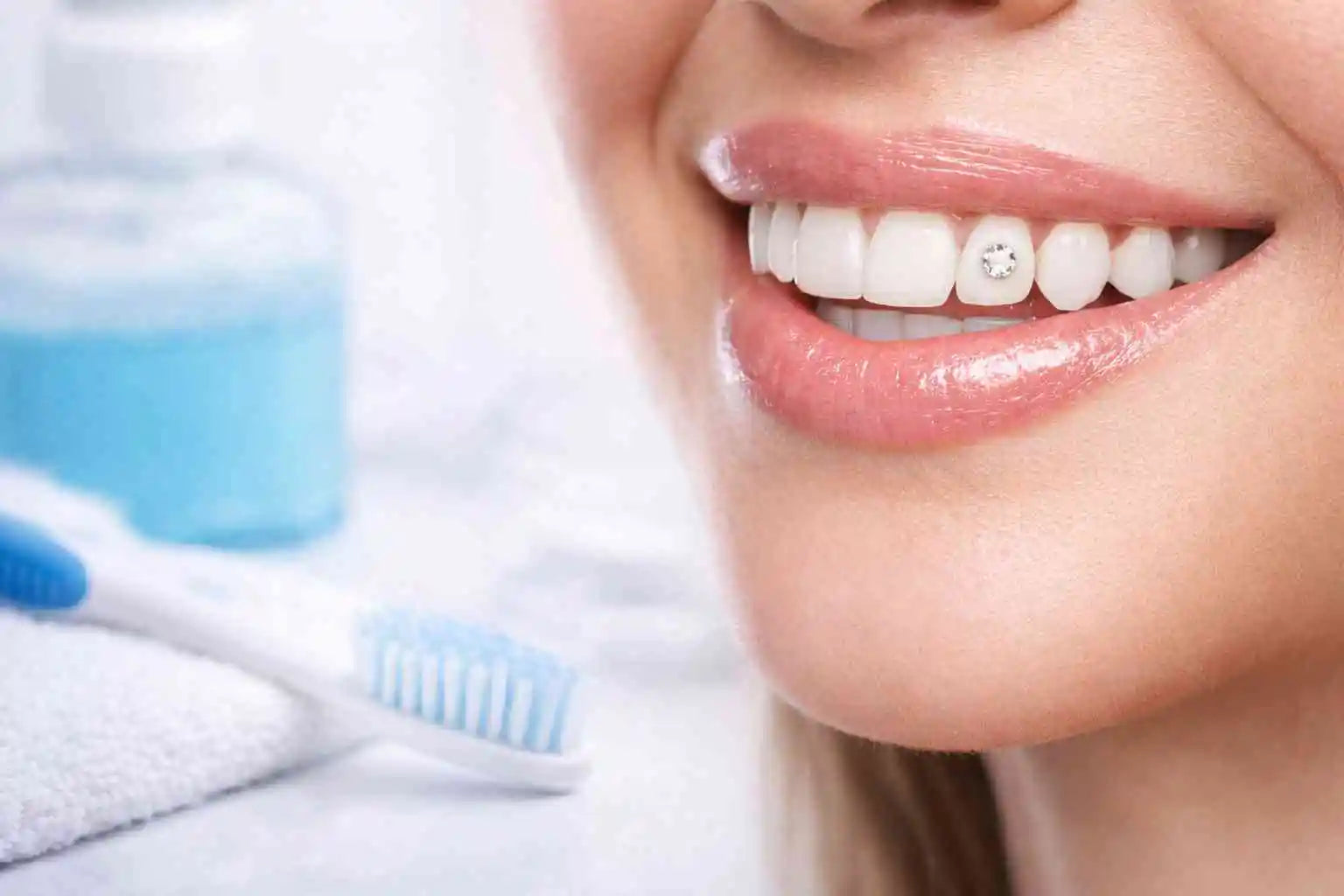 Durée de vie d’un strass dentaire : tenue et entretien