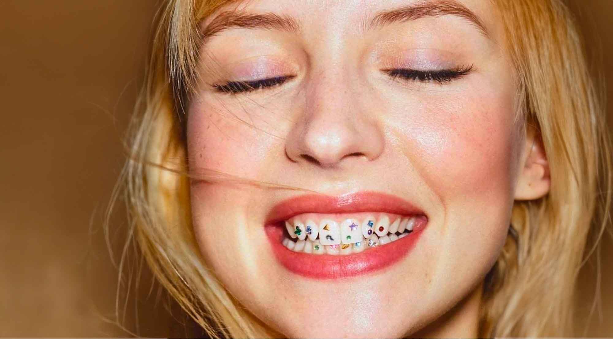 Le Grand Retour des Strass Dentaires en 2024