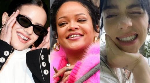 Les Célébrités et les Strass Dentaires