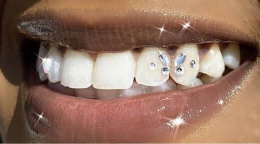 Tooth Gems World : Votre Partenaire pour vos Pose de Strass Dentaire