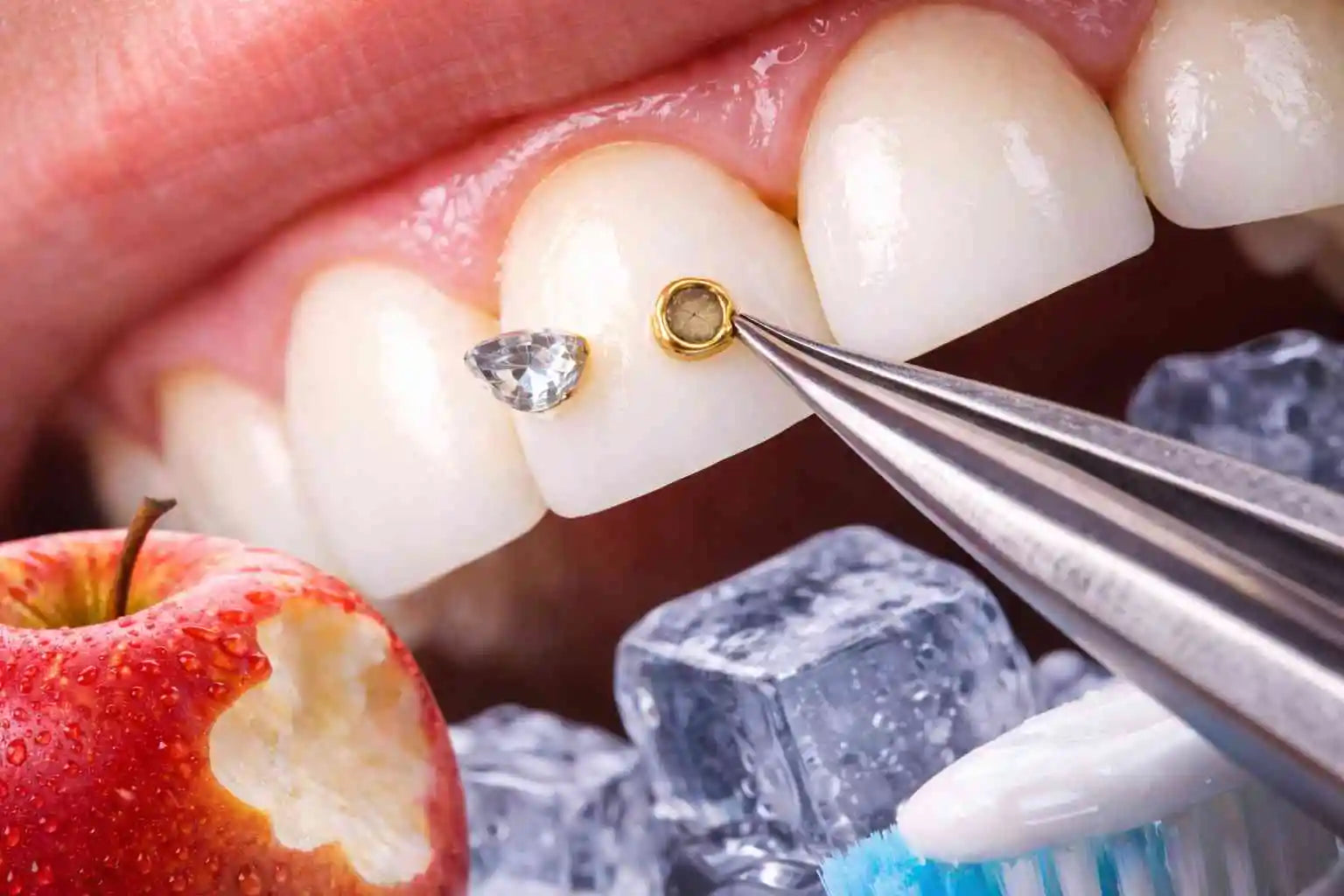 Erreurs fréquentes avec les bijoux dentaires : guide expert