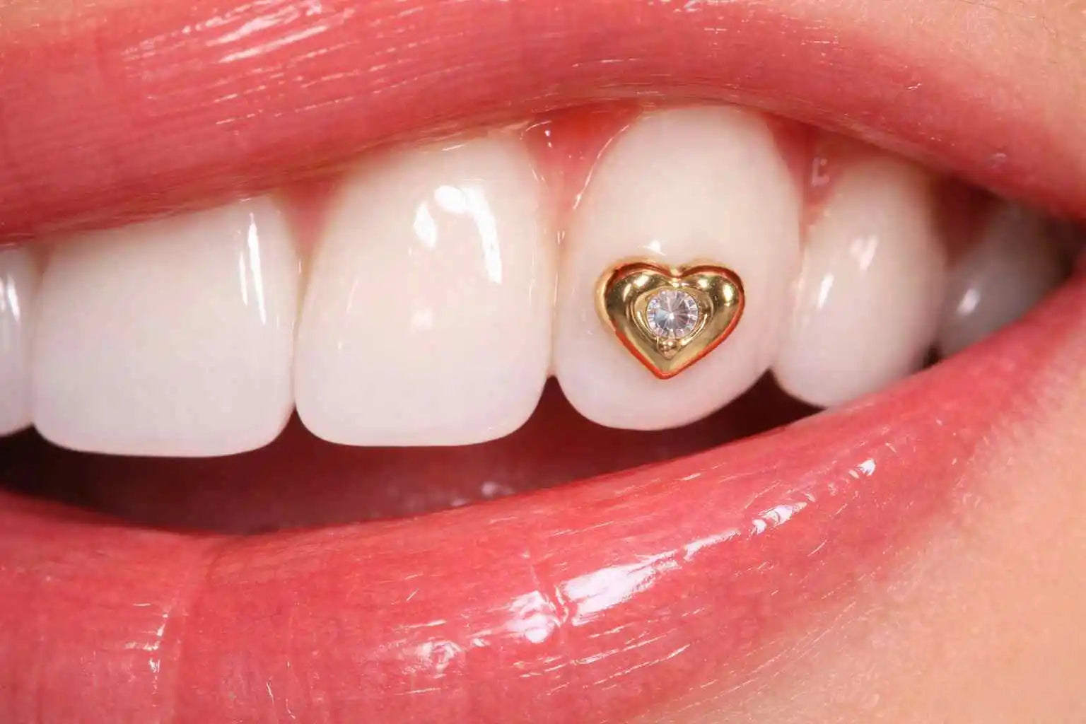 Rendu final d’une pose premium : ce qui fait vraiment la différence