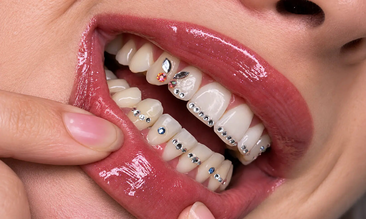 Gros plan d’un sourire après la pose de bijoux dentaires en strass.