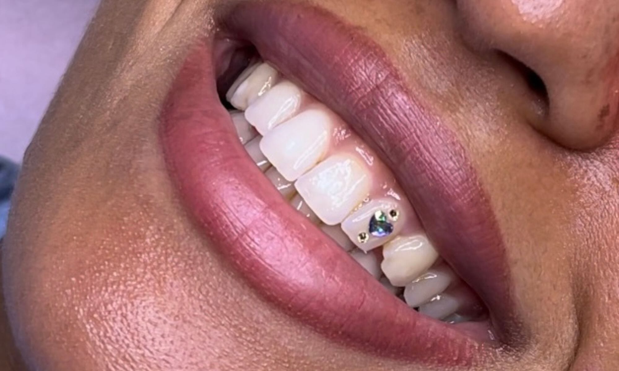 Dentition avec strass dentaire en forme de coeur